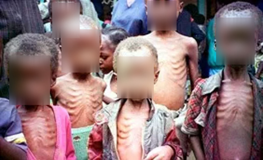 Top 15, pays africains, enfants mal nourris Togo