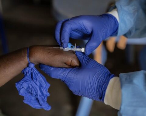 Mpox en RDC : Le gouvernement lance un appel urgent à la population