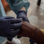 Variole du singe : La RDC annonce le lancement de sa campagne de vaccination anticipée